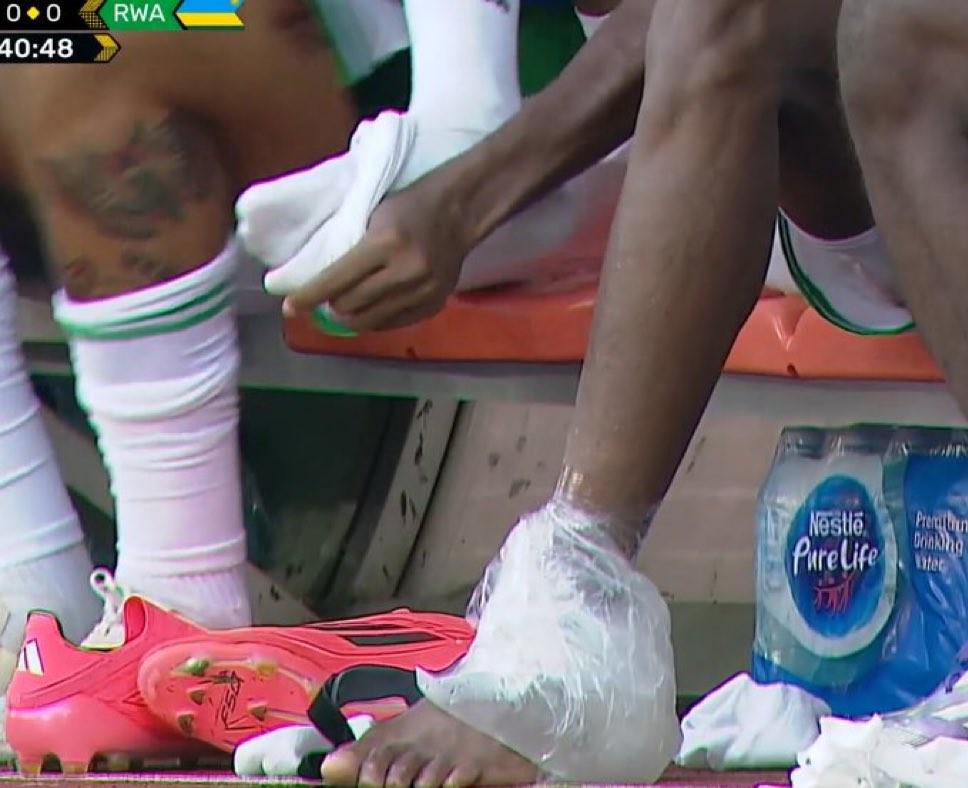 对此意大利, 因为脚踝受 对此意大利, 因为脚踝受